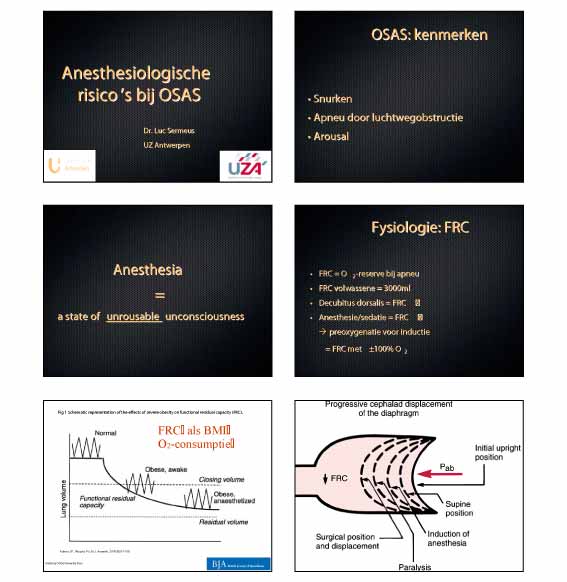 anesthesiebij apneupatiënten